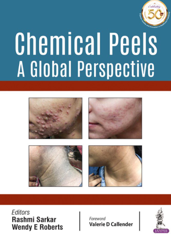 Chemical Peels: A Global Perspective by Rashmi Sarkar PDF Free Download