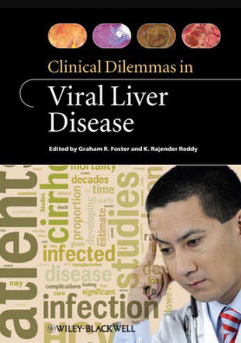 Clinical Dilemmas in Viral Liver Disease PDF Free Download