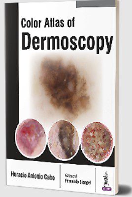 Color Atlas of Dermoscopy by Horacio Antonio Cabo PDF Free Download