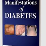 Cutaneous Manifestations of Diabetes by Emilia Noemí Cohen Sabban PDF Free Download