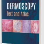 Dermoscopy: Text and Atlas by Subrata Malakar PDF Free Download