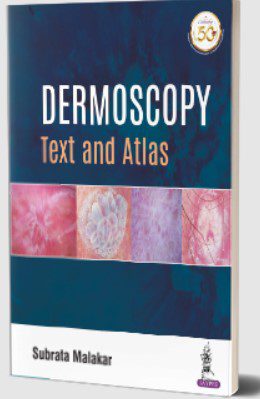 Dermoscopy: Text and Atlas by Subrata Malakar PDF Free Download
