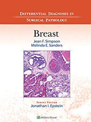 Differential Diagnoses in Surgical Pathology: Breast 2nd Edition PDF Free Download
