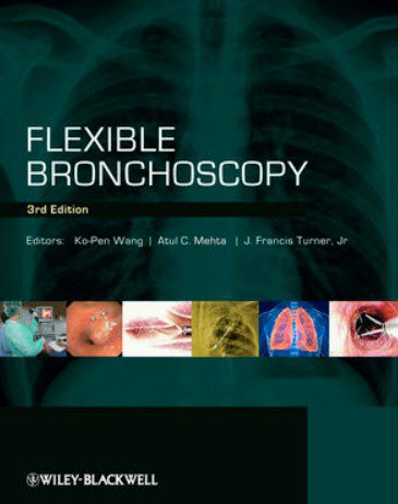 Flexible Bronchoscopy 3rd Edition PDF Free Download