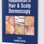 Fundamentals of Hair and Scalp Dermoscopy by Isabella Doche PDF Free Download