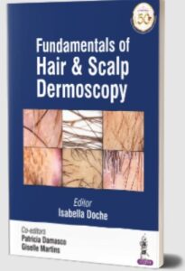 Fundamentals of Hair and Scalp Dermoscopy by Isabella Doche PDF Free Download