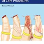 Hand Trauma: Illustrated Surgical Guide of Core Procedures PDF Free Download