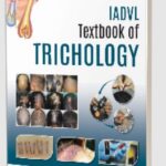 IADVL Textbook of Trichology by Madura C PDF Free Download