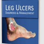Leg Ulcers: Diagnosis and Management by S Sacchidanand PDF Free Download