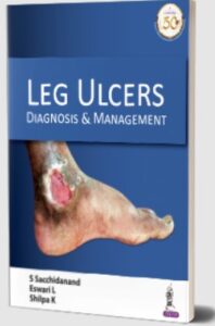 Leg Ulcers: Diagnosis and Management by S Sacchidanand PDF Free Download