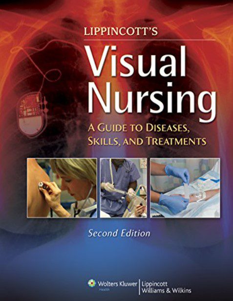 Lippincott's Visual Nursing: A Guide to Diseases 2nd Edition PDF Free Download