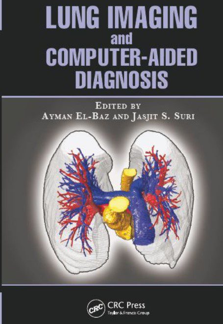 Lung Imaging and Computer Aided Diagnosis PDF Free Download