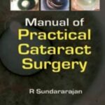 Manual of Practical Cataract Surgery PDF Free Download