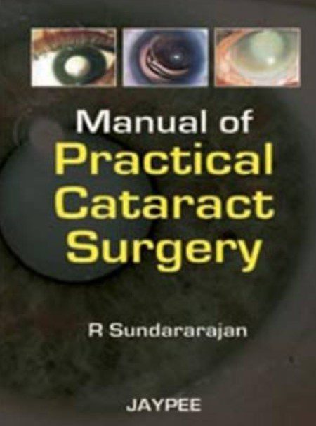 Manual of Practical Cataract Surgery PDF Free Download