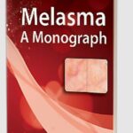 Melasma: A Monograph by Rashmi Sarkar PDF Free Download