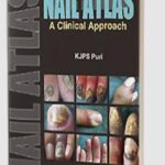 Nail Atlas: A Clinical Approach by KJPS Puri PDF Free Download