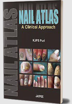 Nail Atlas: A Clinical Approach by KJPS Puri PDF Free Download