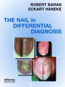 Nail in Differential Diagnosis PDF Free Download