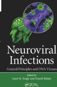 Neuroviral Infections: General Principles and DNA Viruses PDF Free Download