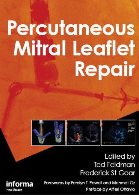 Percutaneous Mitral Leaflet Repair PDF Free Download