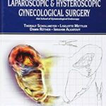 Practical Manual for Laparoscopic & Hysteroscopic Gynecological Surgery PDF Free Download