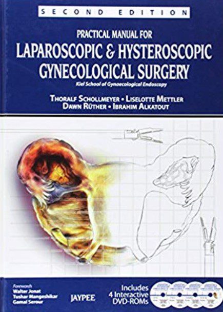 Practical Manual for Laparoscopic & Hysteroscopic Gynecological Surgery PDF Free Download