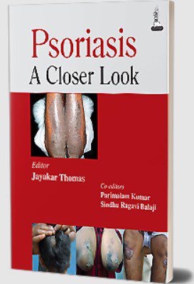 Psoriasis: A Closer Look by Jayakar Thomas PDF Free Download
