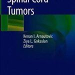 Spinal Cord Tumors PDF Free Download
