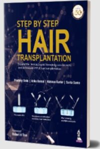 Step by Step Hair Transplantation by Pradeep Sethi PDF Free Download