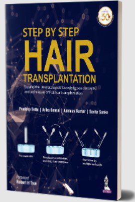 Step by Step Hair Transplantation by Pradeep Sethi PDF Free Download