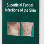 Superficial Fungal Infections of the Skin by Chander Grover PDF Free Download
