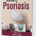 Textbook of Psoriasis by Jayakar Thomas PDF Free Download