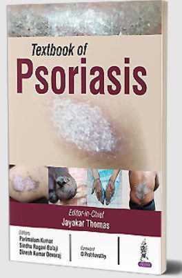 Textbook of Psoriasis by Jayakar Thomas PDF Free Download