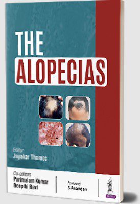 The Alopecias by Jayakar Thomas PDF Free Download