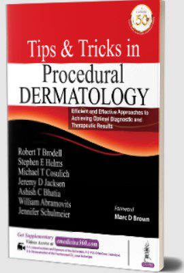 Tips and Tricks in Procedural Dermatology PDF Free Download