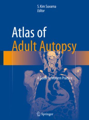 Atlas of Adult Autopsy A Guide to Modern Practice PDF Free Download
