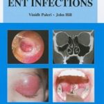 ENT Infections: An Atlas of Investigation and Management PDF Free Download