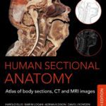 Human Sectional Anatomy 4th Edition PDF Free Download