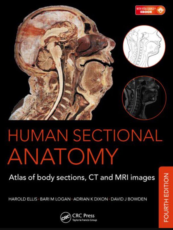 Human Sectional Anatomy 4th Edition PDF Free Download