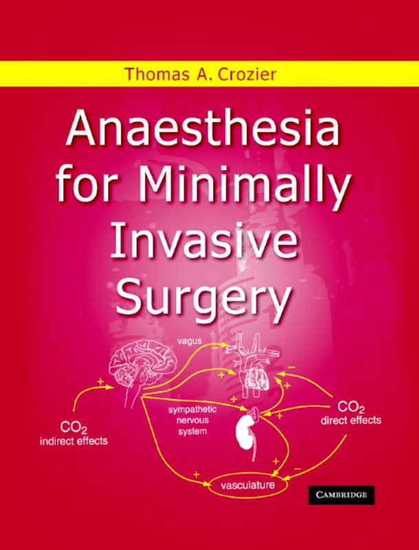 Anaesthesia for Minimally Invasive Surgery PDF Free Download