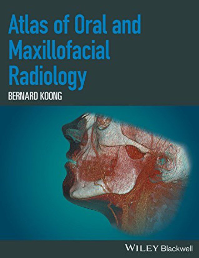 Atlas of Oral and Maxillofacial Radiology PDF Free Download