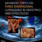Download Advanced Topics on Three-Dimensional Ultrasound in Obstetrics and Gynecology PDF Free
