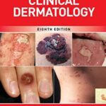 Fitzpatrick's Color Atlas and Synopsis of Clinical Dermatology 8th Edition PDF Free Download