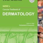 IADVL's Concise Textbook of Dermatology PDF Free Download