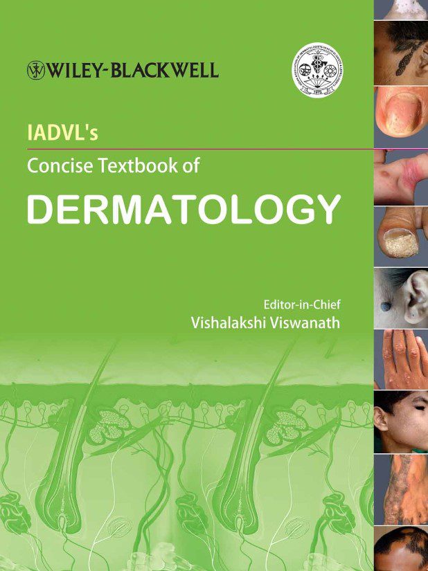 IADVL's Concise Textbook of Dermatology PDF Free Download