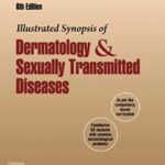Illustrated Synopsis of Dermatology & Sexually Transmitted Diseases 6th Edition PDF Free Download