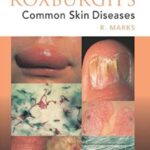 Roxburgh's Common Skin Diseases 17th Edition PDF Free Download