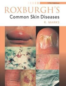 Roxburgh's Common Skin Diseases 17th Edition PDF Free Download