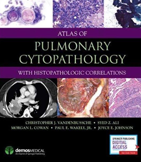 Atlas of Pulmonary Cytopathology PDF Free Download