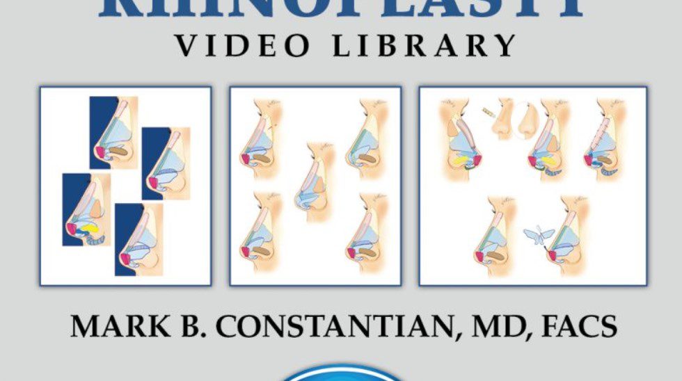 Constantian Rhinoplasty Video Library Volumes 1, 2, & 3 Videos Free Download
